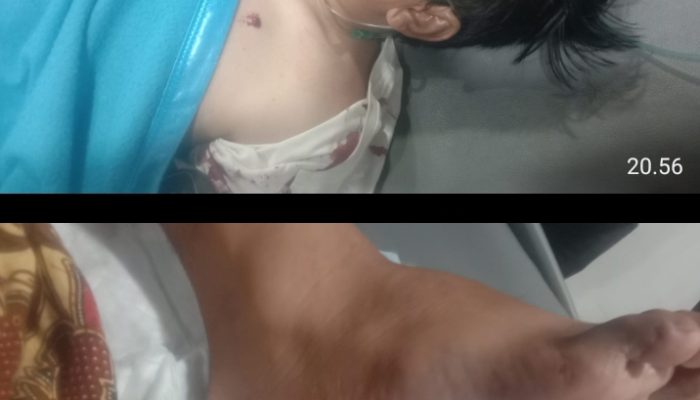 Kinerja Cepat Polres Simalungun Amankan Pelaku Penembakan Massal di Perumahan Rorinata 5 Warga Terluka